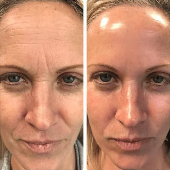  — before and after