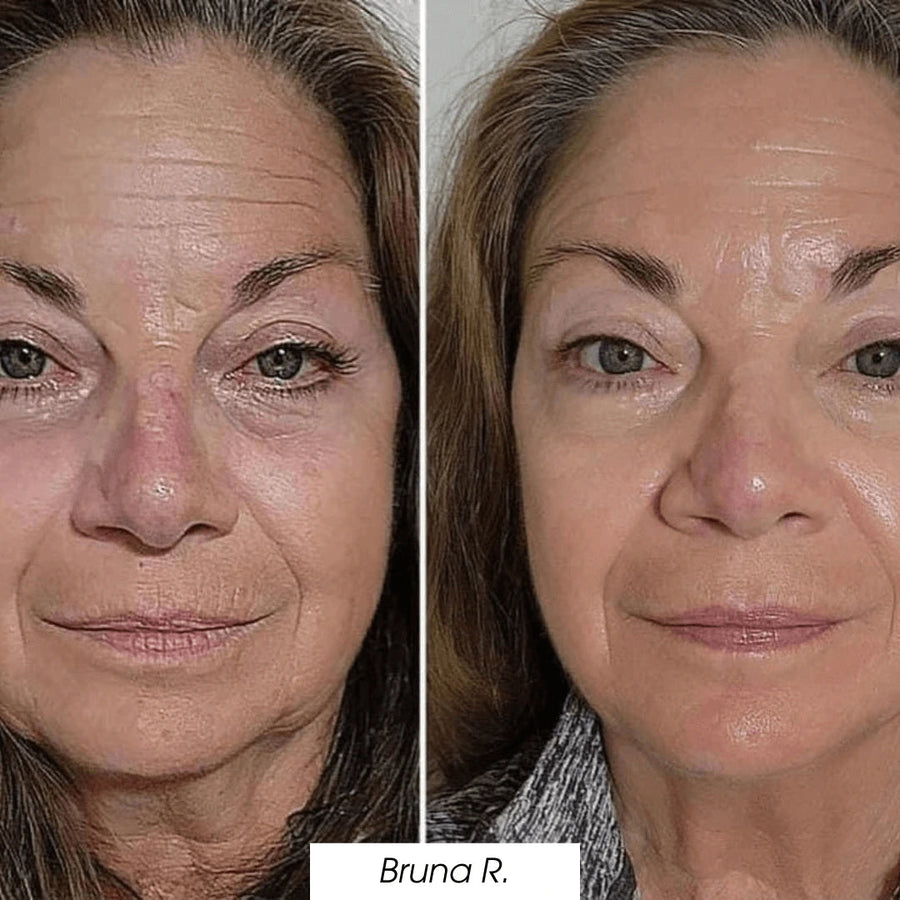  — before and after