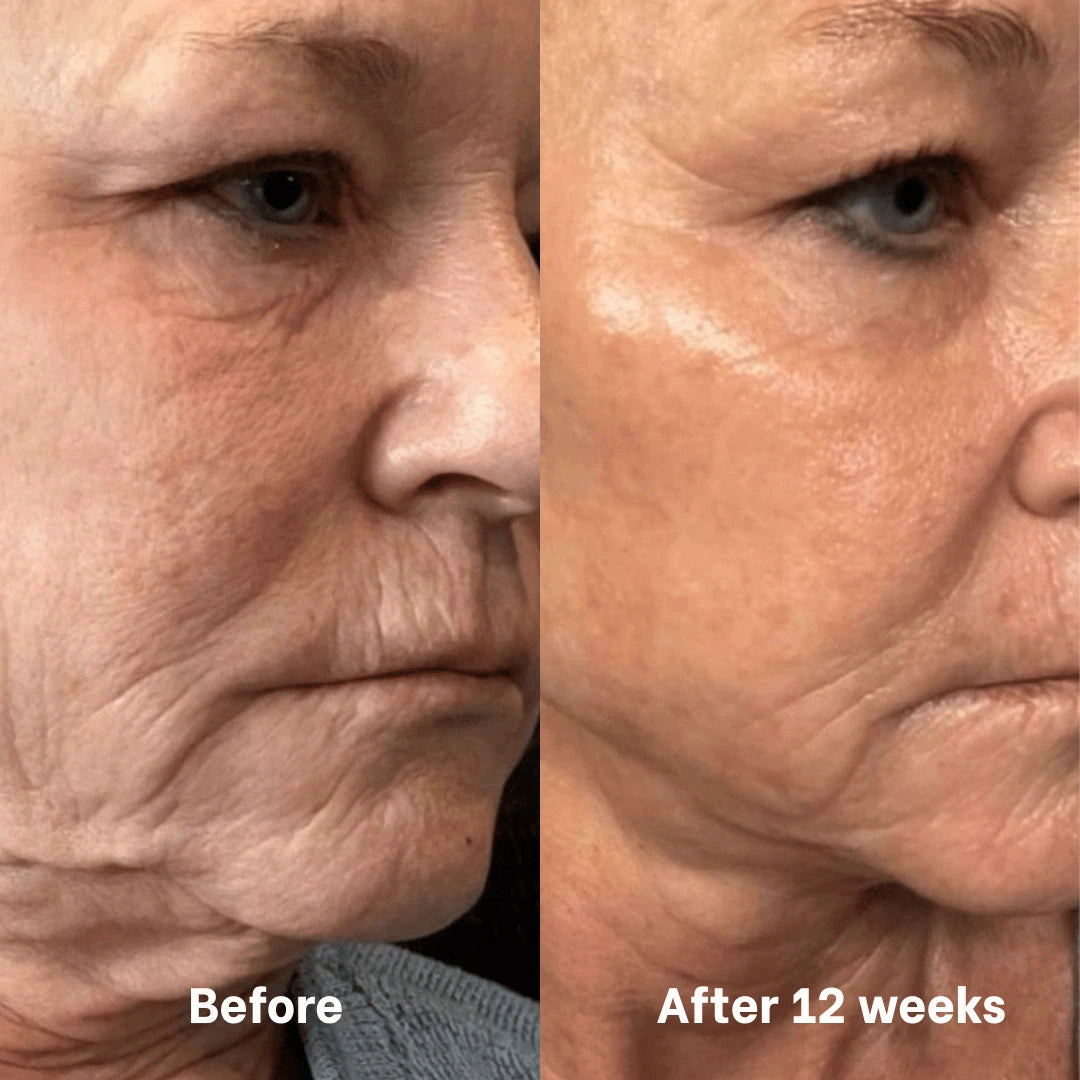Regenerating Mask with Hydrolysed Collagen and Niacinamide