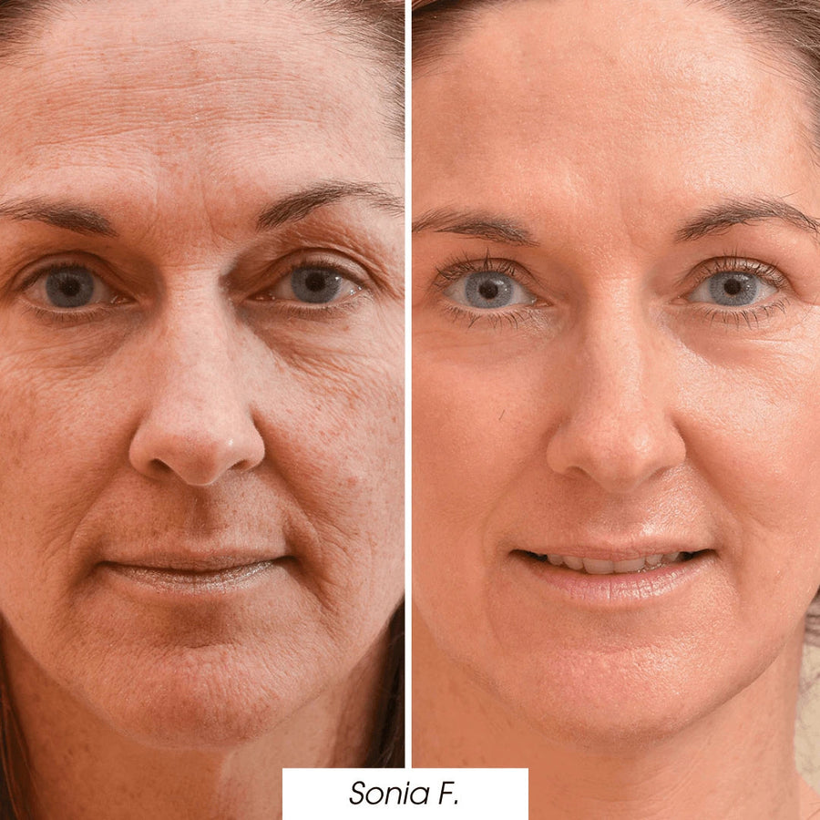  — before and after