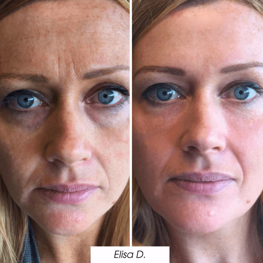  — before and after