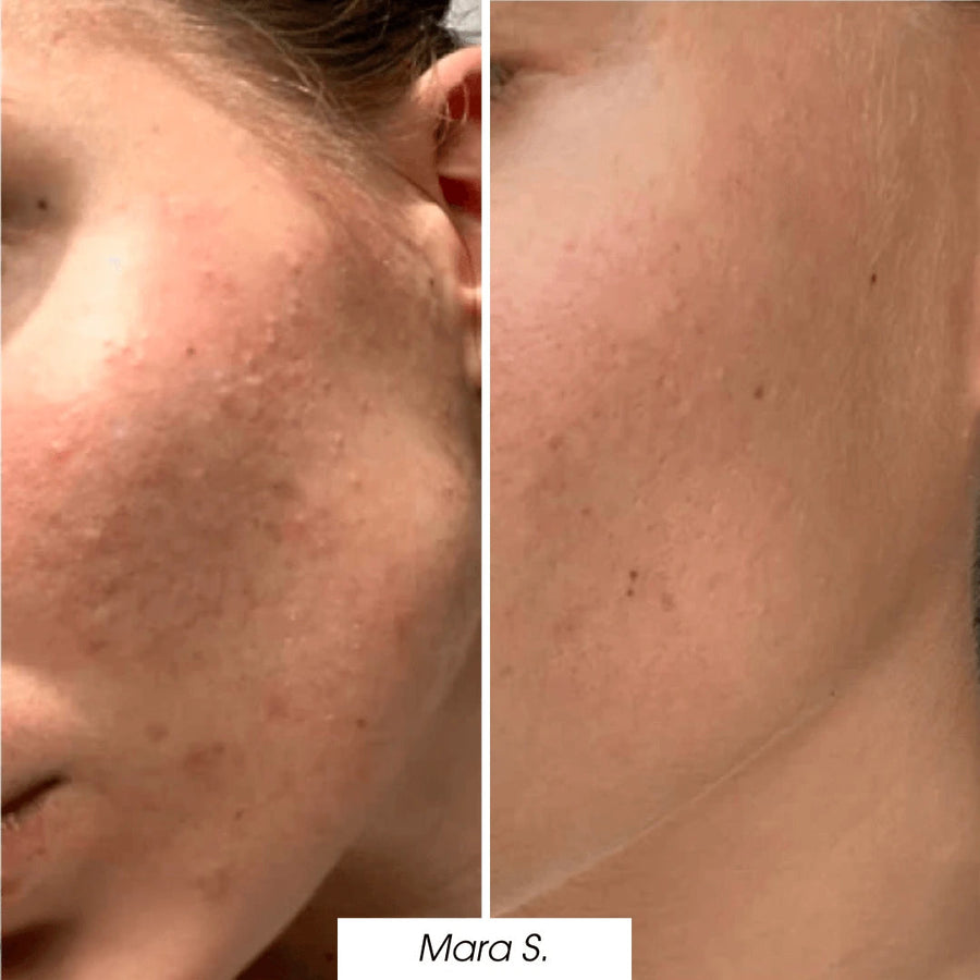  — before and after